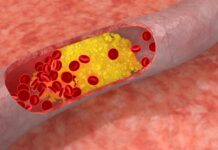 Nuevas guías colesterol 2026: qué cambia y qué debes preguntarle a tu médico